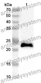 Anti-Human DYNLL2 Polyclonal Antibody