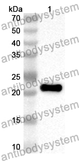 Anti-Human KCNE4 Polyclonal Antibody