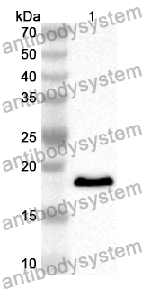 Anti-Human BCL7B Polyclonal Antibody