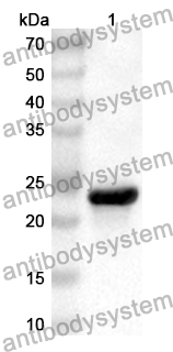 Anti-Human CEP112 Polyclonal Antibody