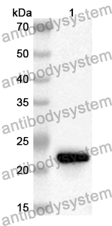 Anti-Human KRT12 Polyclonal Antibody