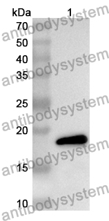 Anti-Human CERS2 Polyclonal Antibody