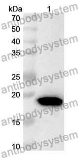 Anti-Human LYSMD3 Polyclonal Antibody