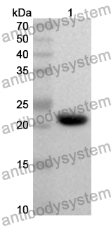 Anti-Human SGMS1 Polyclonal Antibody