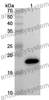 Anti-Human AGTRAP Polyclonal Antibody