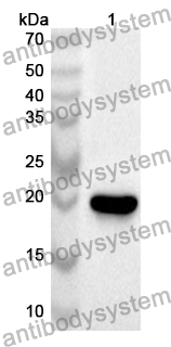 Anti-Human SOX13 Polyclonal Antibody