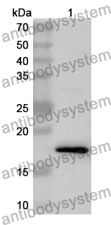 Anti-Human TP53INP1 Polyclonal Antibody