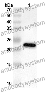 Anti-Human ACBD5 Polyclonal Antibody