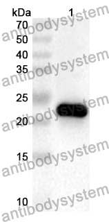 Anti-Human ARL5B Polyclonal Antibody