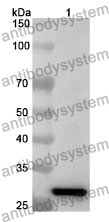 Anti-Human SMTNL1 Polyclonal Antibody