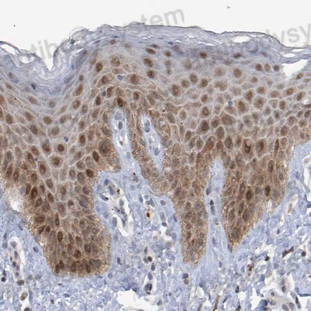 Immunohistochemical for Anti-Human ESRP1 Polyclonal Antibody ?>