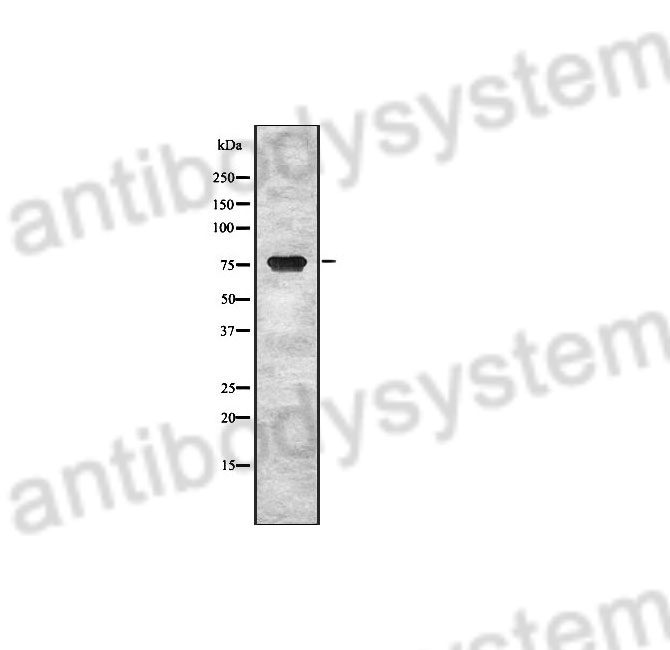 Western Blot for Anti-Human ESRP1 Polyclonal Antibody ?>