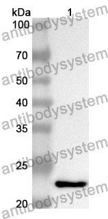 Anti-Human ESRP1 Polyclonal Antibody