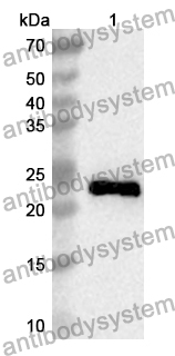 Anti-Human CRACR2A Polyclonal Antibody