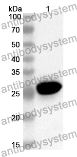 Anti-Human GSDMB Polyclonal Antibody