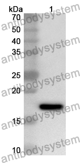 Anti-Human AFAP1L2 Polyclonal Antibody