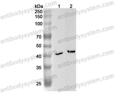 Anti-Human B4GALT6 Polyclonal Antibody