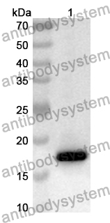 Anti-Human CEP19 Polyclonal Antibody