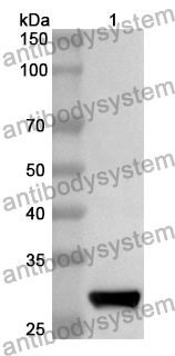 Anti-Human ANKRD27 Polyclonal Antibody