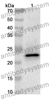 Anti-Human COQ5 Polyclonal Antibody