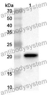 Anti-Human MTIF3 Polyclonal Antibody