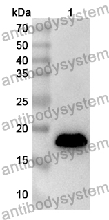 Anti-Human YEATS2 Polyclonal Antibody