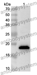 Anti-Human OTUD6A Polyclonal Antibody