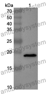 Anti-Human ZC3H12D Polyclonal Antibody