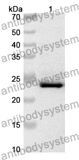 Anti-Human IFT43 Polyclonal Antibody