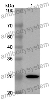 Anti-Human ALKBH7 Polyclonal Antibody