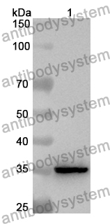 Anti-Human APH1A Polyclonal Antibody