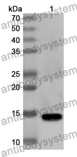 Anti-Human SEZ6L2 Polyclonal Antibody