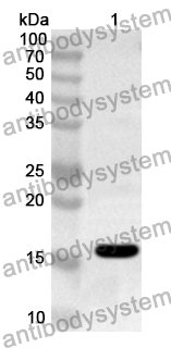 Anti-Human ALG13 Polyclonal Antibody