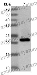 Anti-Human MCPH1 Polyclonal Antibody