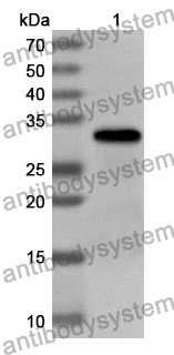 Anti-Human NEIL3 Polyclonal Antibody