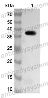 Anti-Human NINJ1 Polyclonal Antibody