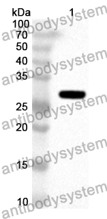 Anti-Human E2F7 Polyclonal Antibody