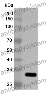 Anti-Human FBXO17 Polyclonal Antibody