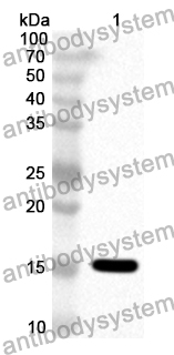 Anti-Human CHFR Polyclonal Antibody