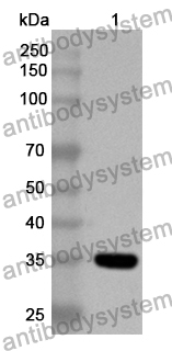 Anti-Human C1GALT1C1 Polyclonal Antibody