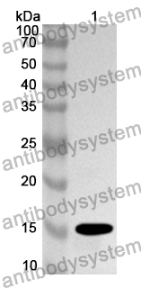 Anti-Human MCRS1 Polyclonal Antibody