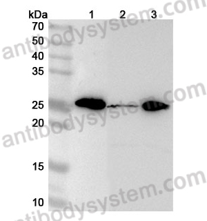 Anti-Human MRPL48 Polyclonal Antibody