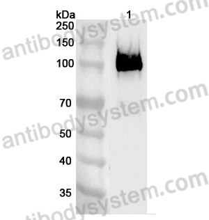 Anti-Human TCTN2 Polyclonal Antibody