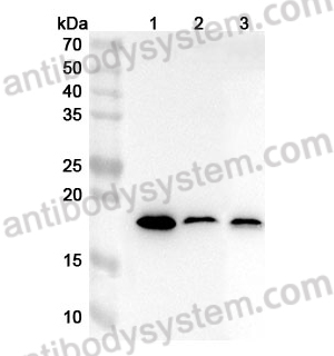 Anti-Human COQ10A Polyclonal Antibody