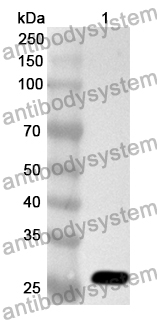 Anti-Human SECISBP2 Polyclonal Antibody