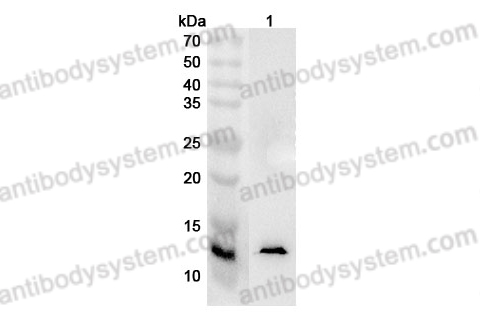 Anti-Human MYCBP Polyclonal Antibody