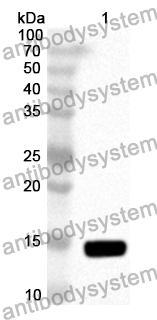 Anti-Human RNF2 Polyclonal Antibody