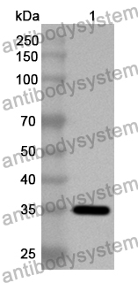 Anti-Human PIK3R4 Polyclonal Antibody