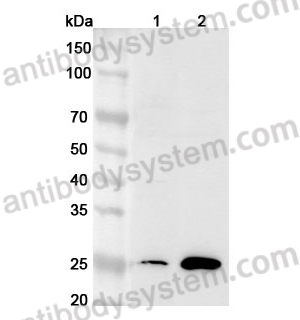 Anti-Human CDCA3 Polyclonal Antibody