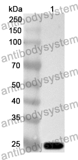 Anti-Human ELAC2 Polyclonal Antibody